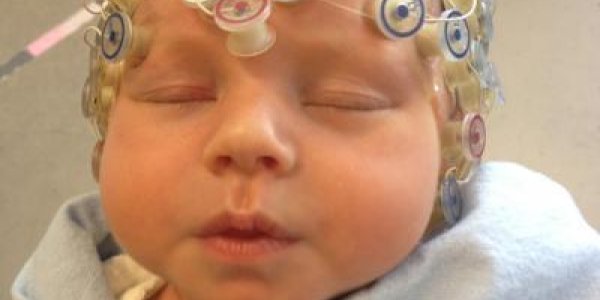 Exercise During Pregnancy - It's Good For Baby Brains