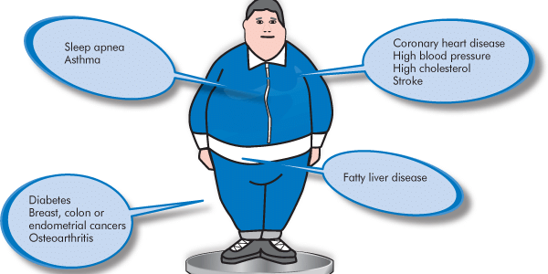 Smokers Relieved - Obesity Is Getting Blamed For Everything Now