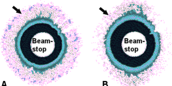 The Biomechanics of Amnion Rupture: An X-Ray Diffraction Study