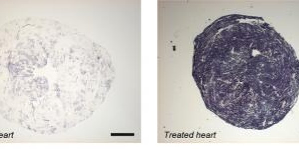 Friedreich's Ataxia -- An Effective Gene Therapy In An Animal Model
