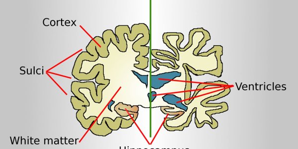 "Self-Devouring"- The Answer To Neurodegenerative Diseases ?