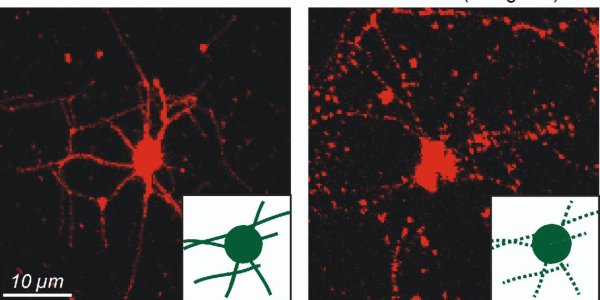Lipids Are Said To Boost The Brain - But How?