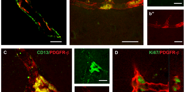 New Stem Cell Found In The Brain - And It Can Form New Brain Cells