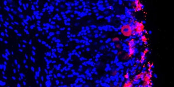 Stem Cells Provide Lasting Pain Relief In Mice