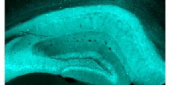 Why Don't Antidepressants Act Faster?