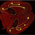 Article teaser image