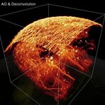 Article teaser image