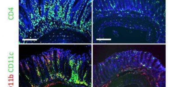 Butyrate As Therapy: Fatty Acid Produced By Gut Bacteria Boosts Immune System