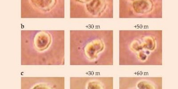 Electric Fields As Cancer Treatment