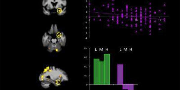 Empathy In Psychopaths: A Neurological Basis?