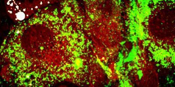 Findings show insulin -- not genes -- linked to obesity