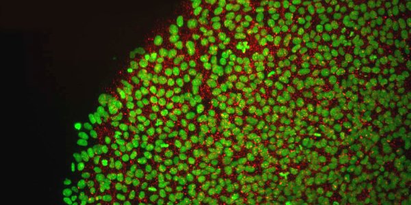 The Internal Debate Over Stem Cell Research