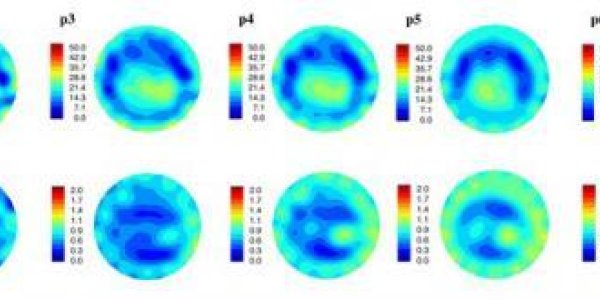 Better Breast Cancer Imaging