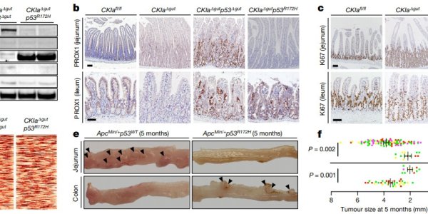 Colon Cancer Mystery: Are Too Many Antioxidants The Problem?