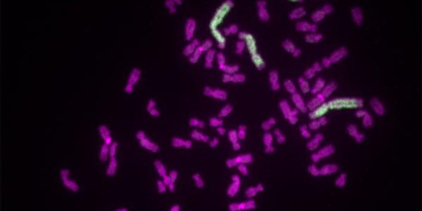 Tumors And The Mystery Of 'Frankenstein' DNA