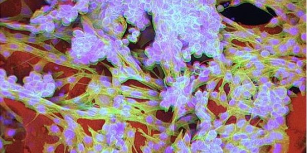 Injectable Cryogel-based Whole-cell Cancer Vaccines