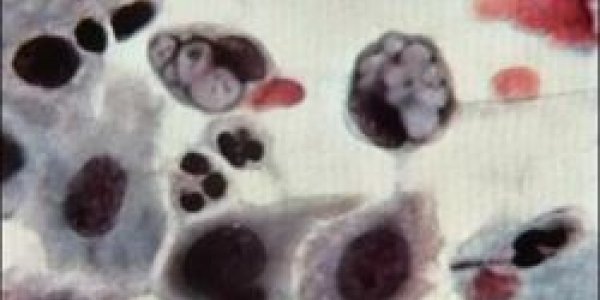 Greenhouse Gas-Eating Bug From Hell's Gate May Help Fight Global Warming