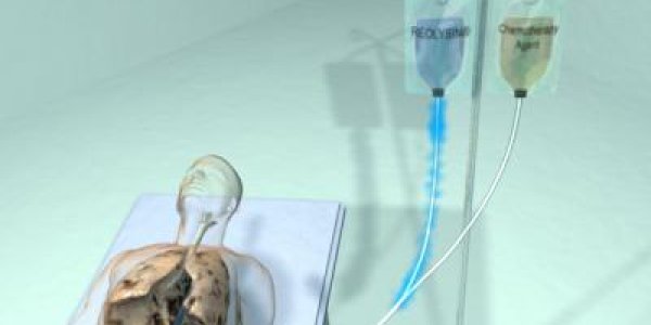 Oncolytic viruses plus anti-cancer drugs work better than either alone