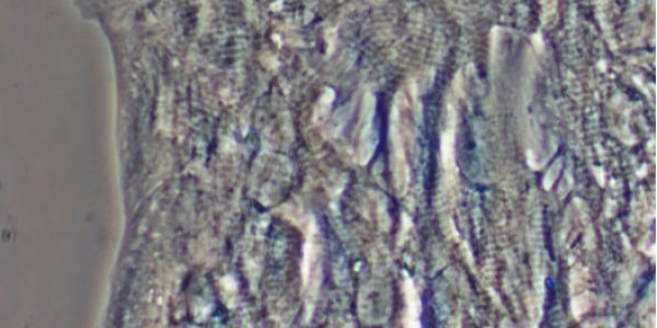 Breakthrough: Two Obstacles To Stem Cell Heart Repair Overcome