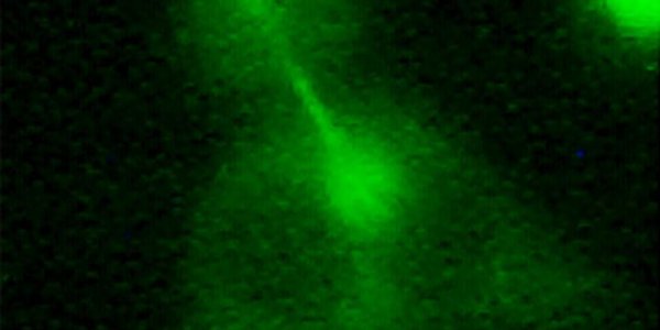 Triple Barrier Prevents Cells From Becoming Cancerous