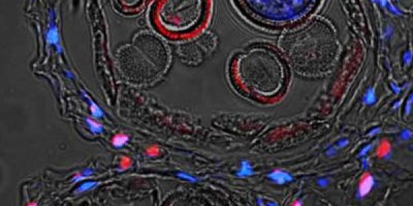 Programmed Cell Death - In Plants, Animals And Humans, One Thing We All Have In Common