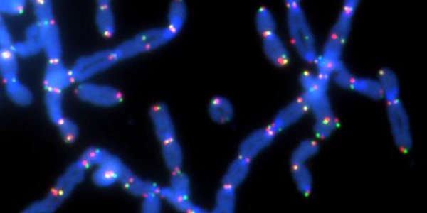 PolQ Enzyme Action Slows BRCA Tumor Growth