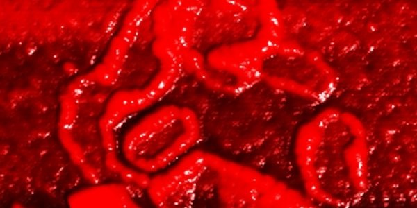 Atomic Force Microscopy May Lead To Detecting Dementia In The Blood