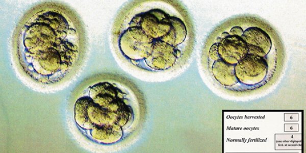 Octomom, Genetic Engineering And A Brave New World: The Ethics Of IVF