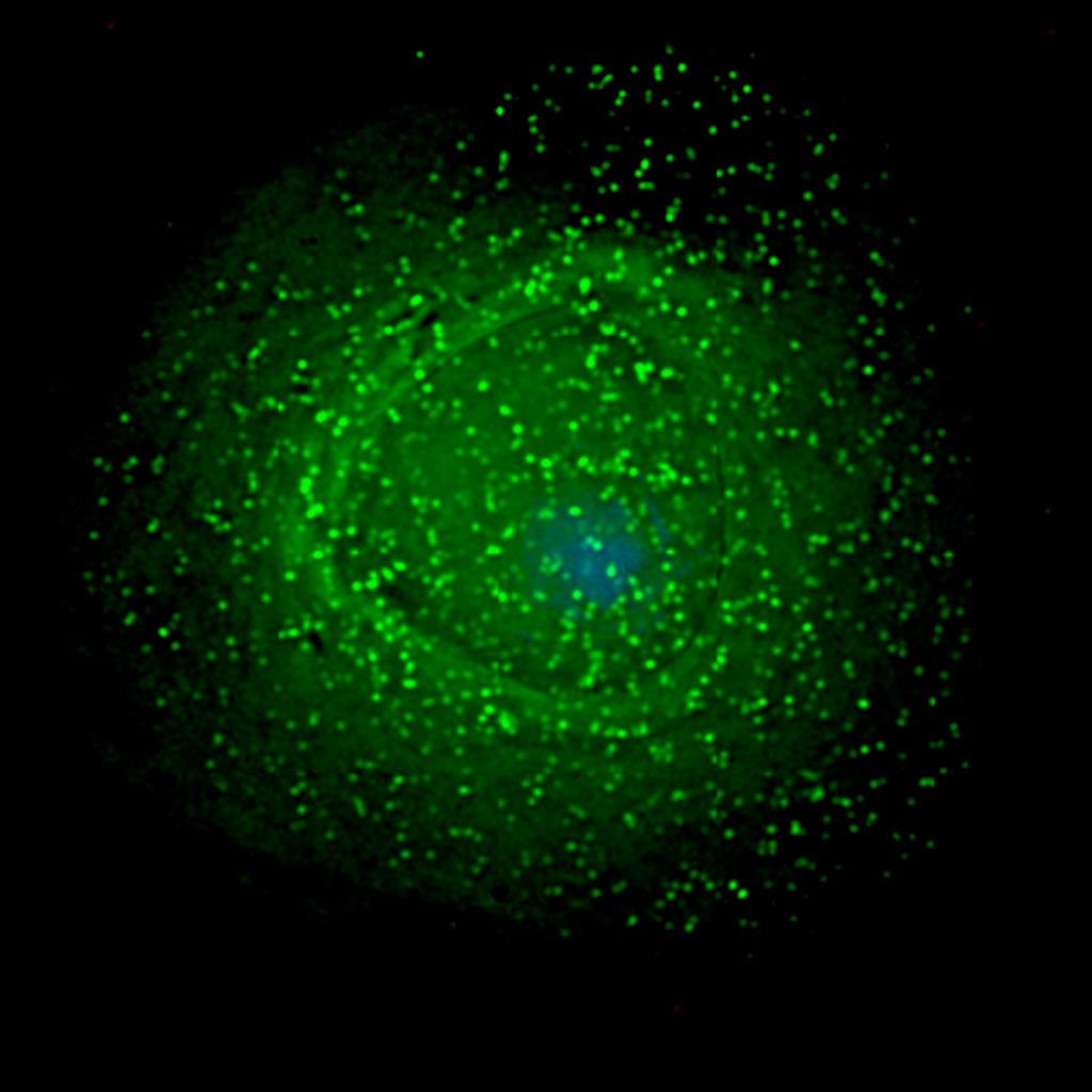 HIV_on_macrophage