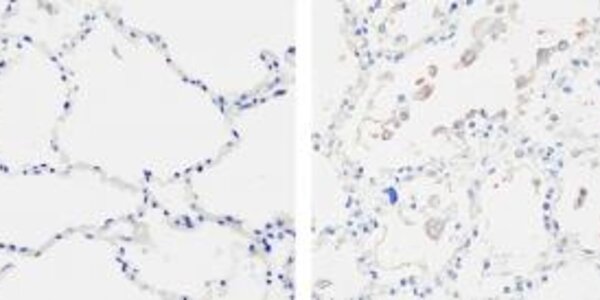 Article teaser image