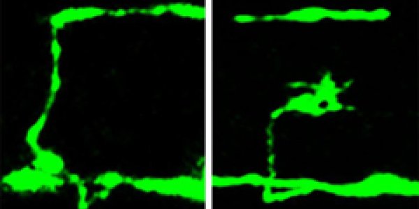 Mutant gene may have affected Abe Lincoln