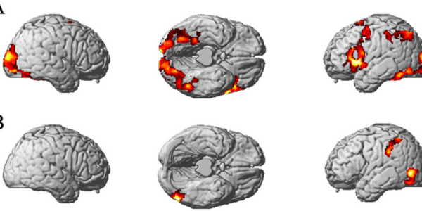 Article teaser image