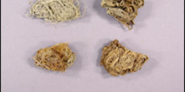 Article teaser image