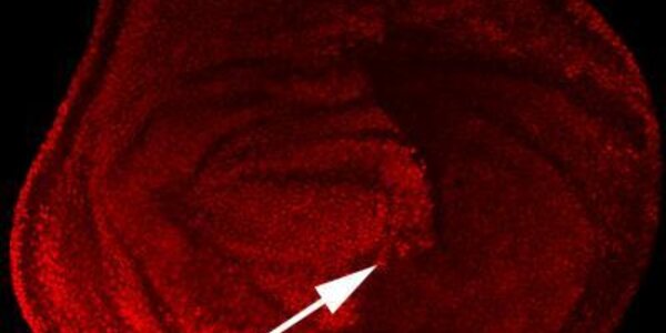 Article teaser image