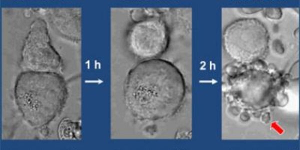 Article teaser image