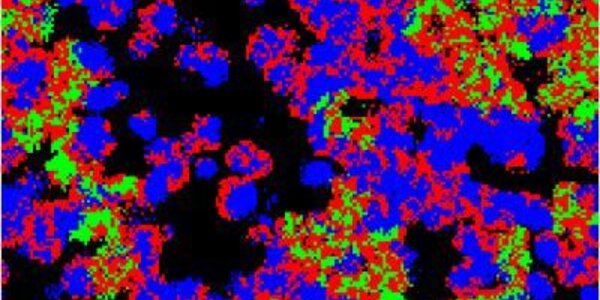 Article teaser image