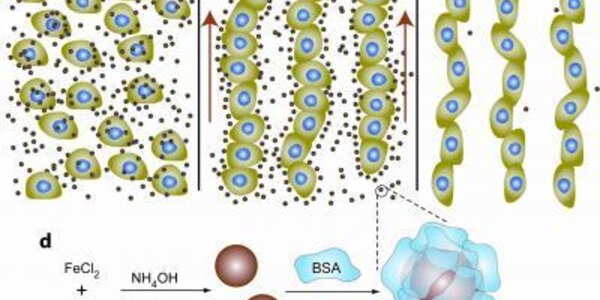 Article teaser image