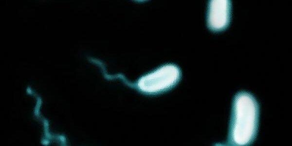 Article teaser image