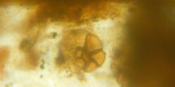 Article teaser image