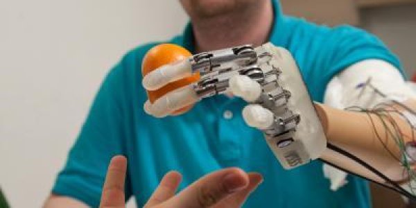 Bionic Hand Gives Amputee Real-Time Ability To Feel