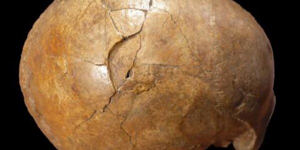 Article teaser image