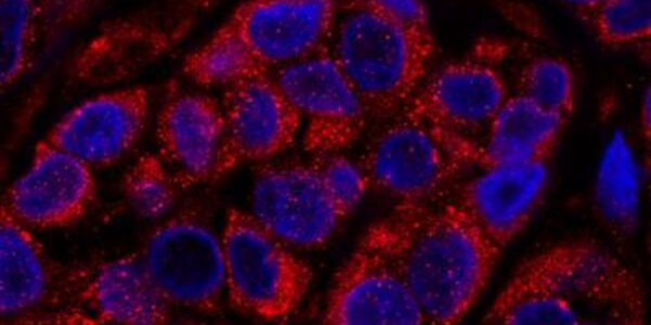 Article teaser image