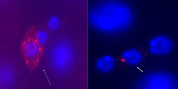 Article teaser image