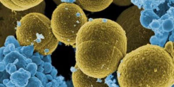 Tracing The Evolution Of The CA-MRSA 'Superbug'