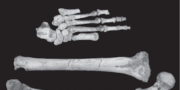 Article teaser image