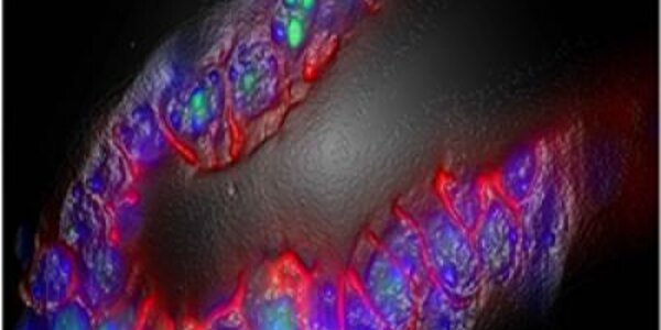 Article teaser image