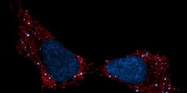 Mitochondria Send Out Cellular Distress Signals When DNA Are Damaged, Like In Chemotherapy