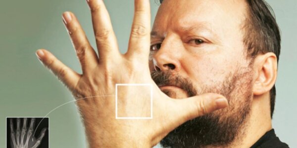 Article teaser image