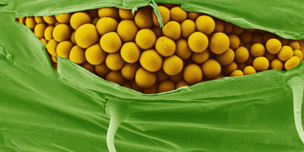 Article teaser image