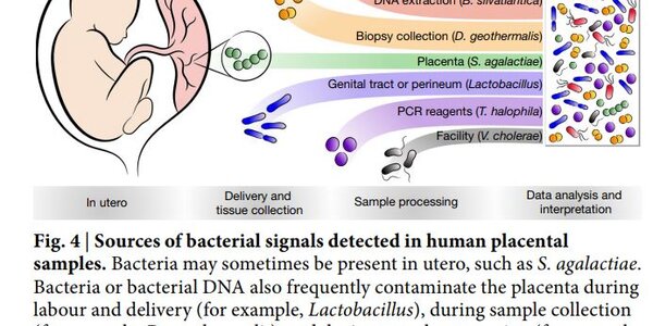 Article teaser image